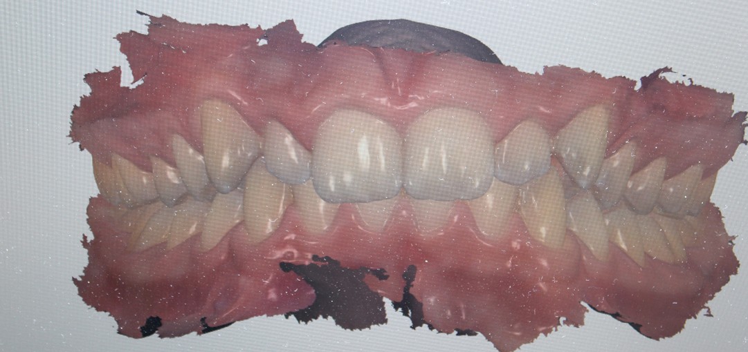 Dr Demuyter